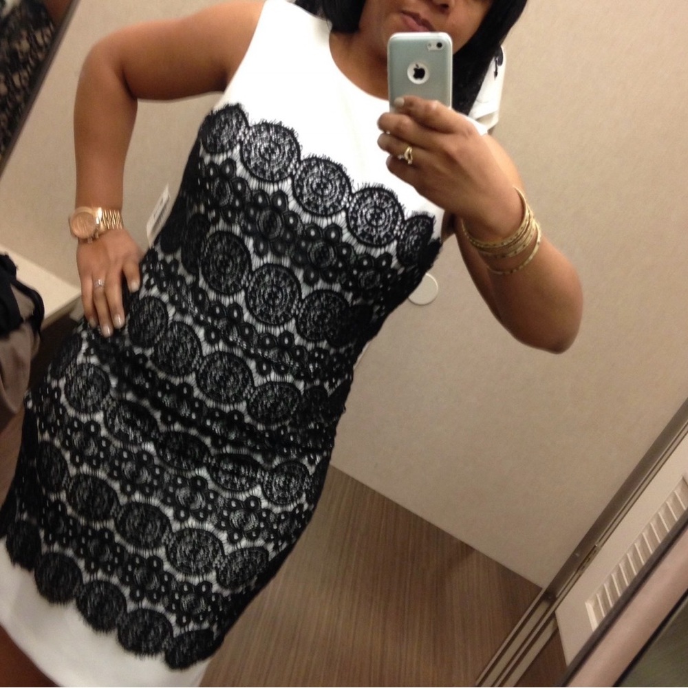 Elegant Black and White Lace Dress